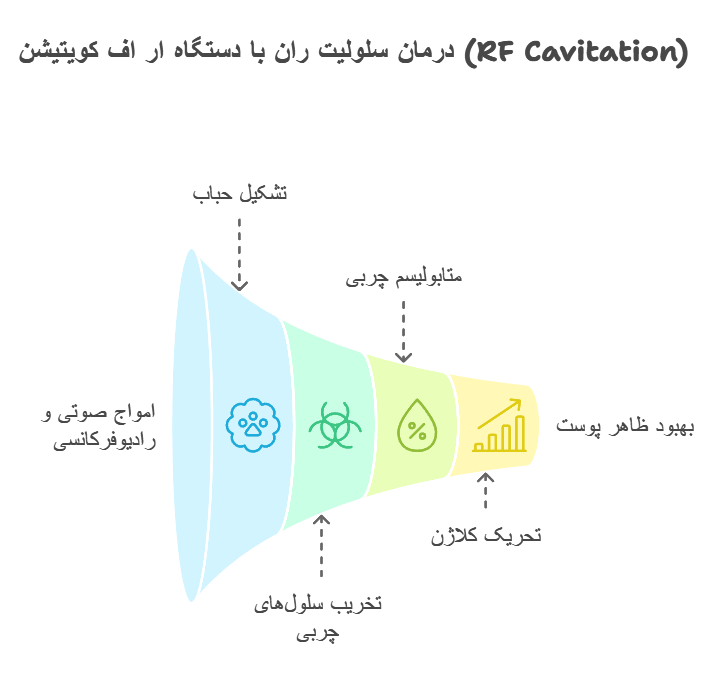 درمان سلولیت ران با دستگاه ار اف کویتیشن (RF Cavitation)