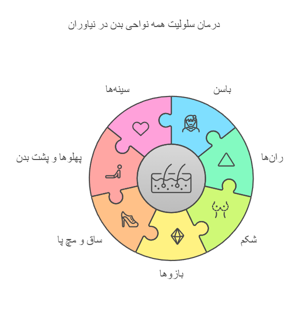 درمان سلولیت همه نواحی بدن در نیاوران