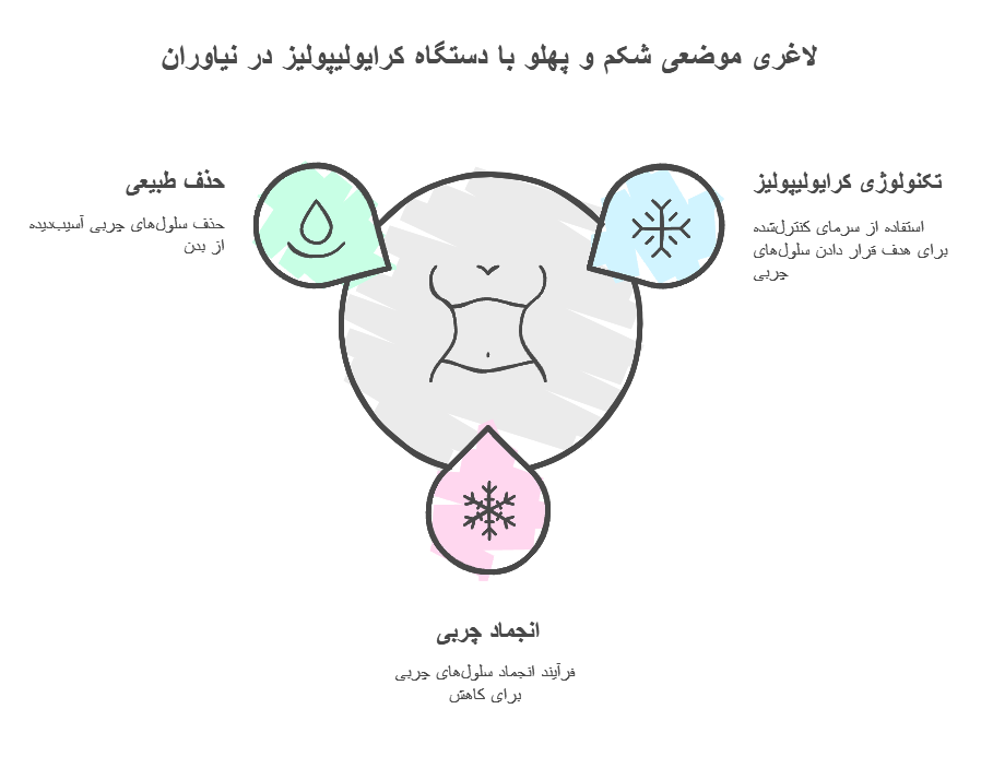 لاغری موضعی شکم و پهلو با دستگاه کرایولیپولیز در نیاوران