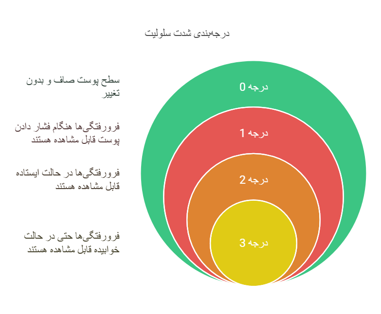 درجه بندی سلولیت
