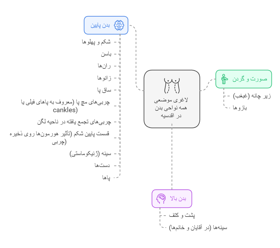 لاغری موضعی همه نواحی بدن در اقدسیه