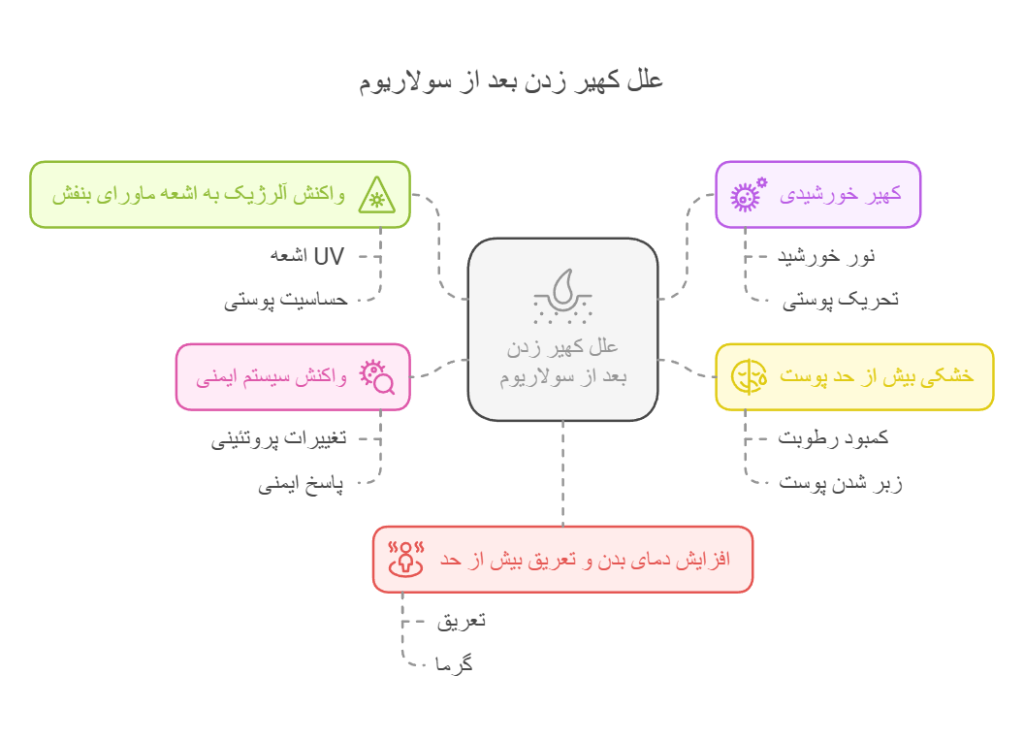 علل کهیر زدن بعد از سولاریوم