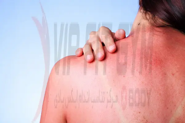 استفاده از ترکیبات ضدالتهابی طبیعی