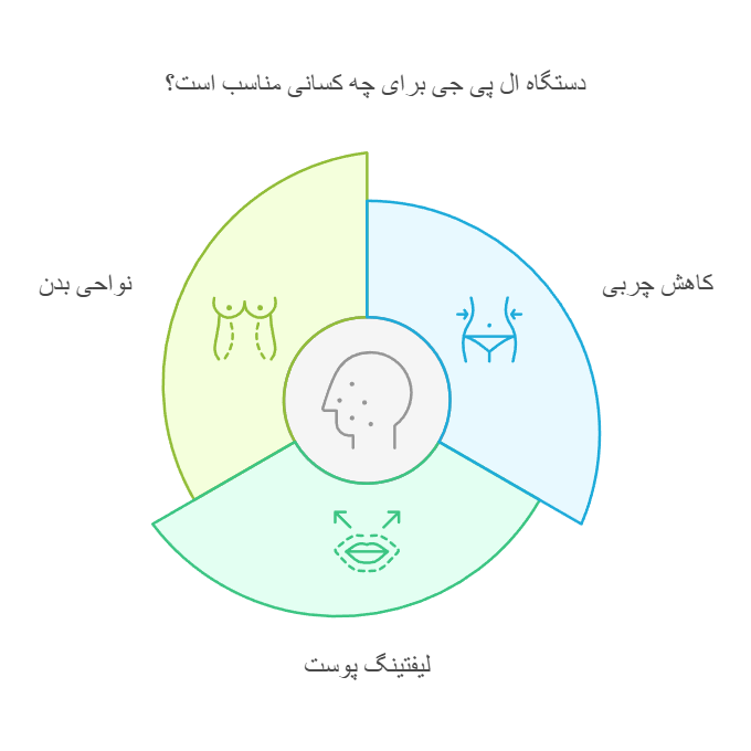 دستگاه ال پی جی برای چه کسانی مناسب است؟