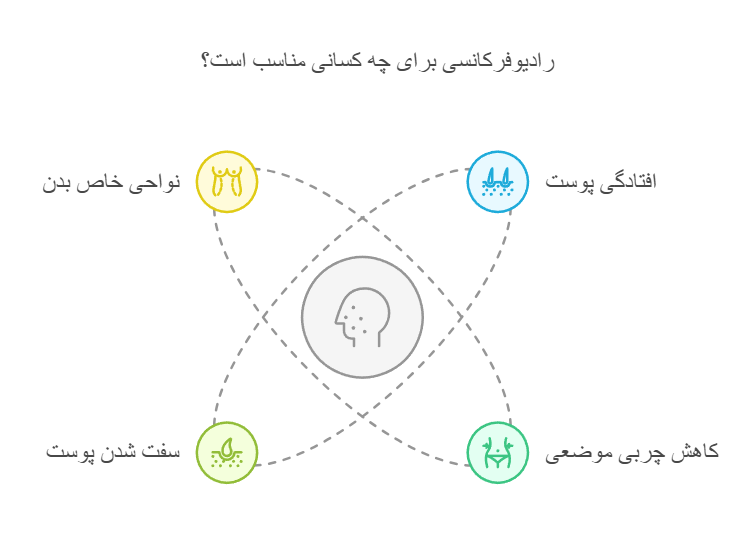 رادیوفرکانسی برای چه کسانی مناسب است؟