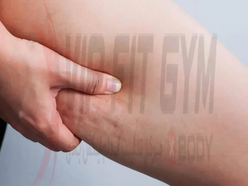 تفاوت سلولیت و باد سرخ چیست؟ - بررسی کامل عوارض و علل